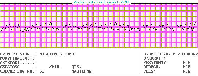 Wykresy EKG - c52-0.png